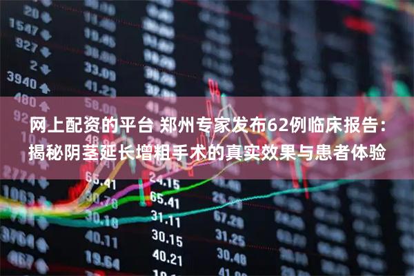 网上配资的平台 郑州专家发布62例临床报告：揭秘阴茎延长增粗手术的真实效果与患者体验
